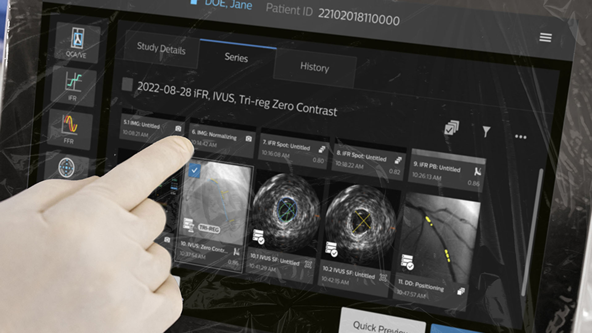 Philips launches IntraSight Plus to simplify coronary interventions and advance precision care